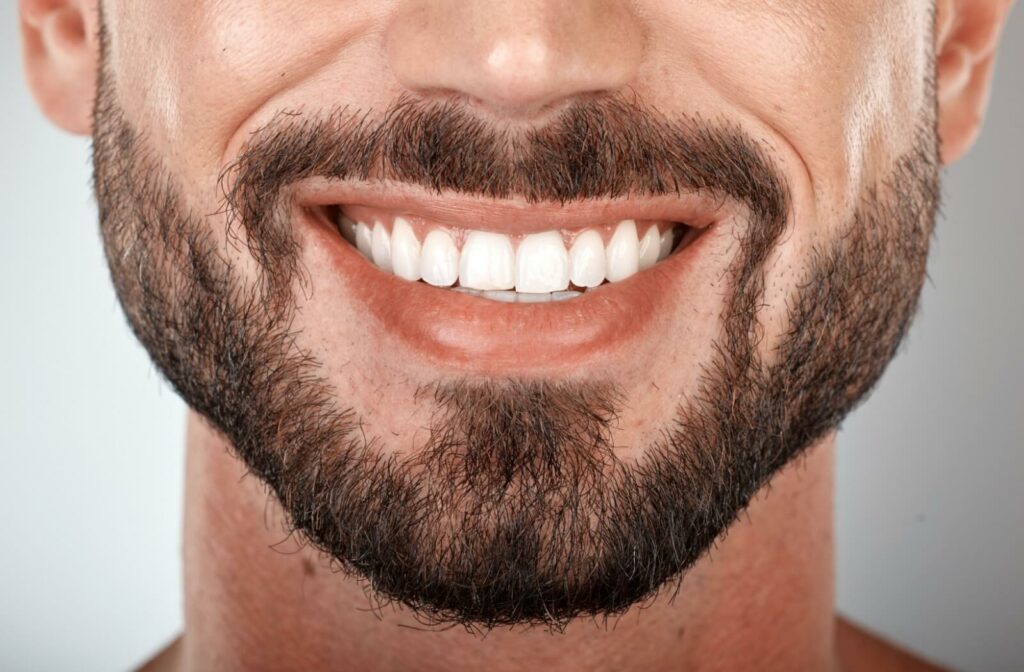 A close-up image of a bearded man smiling after teeth whitening.