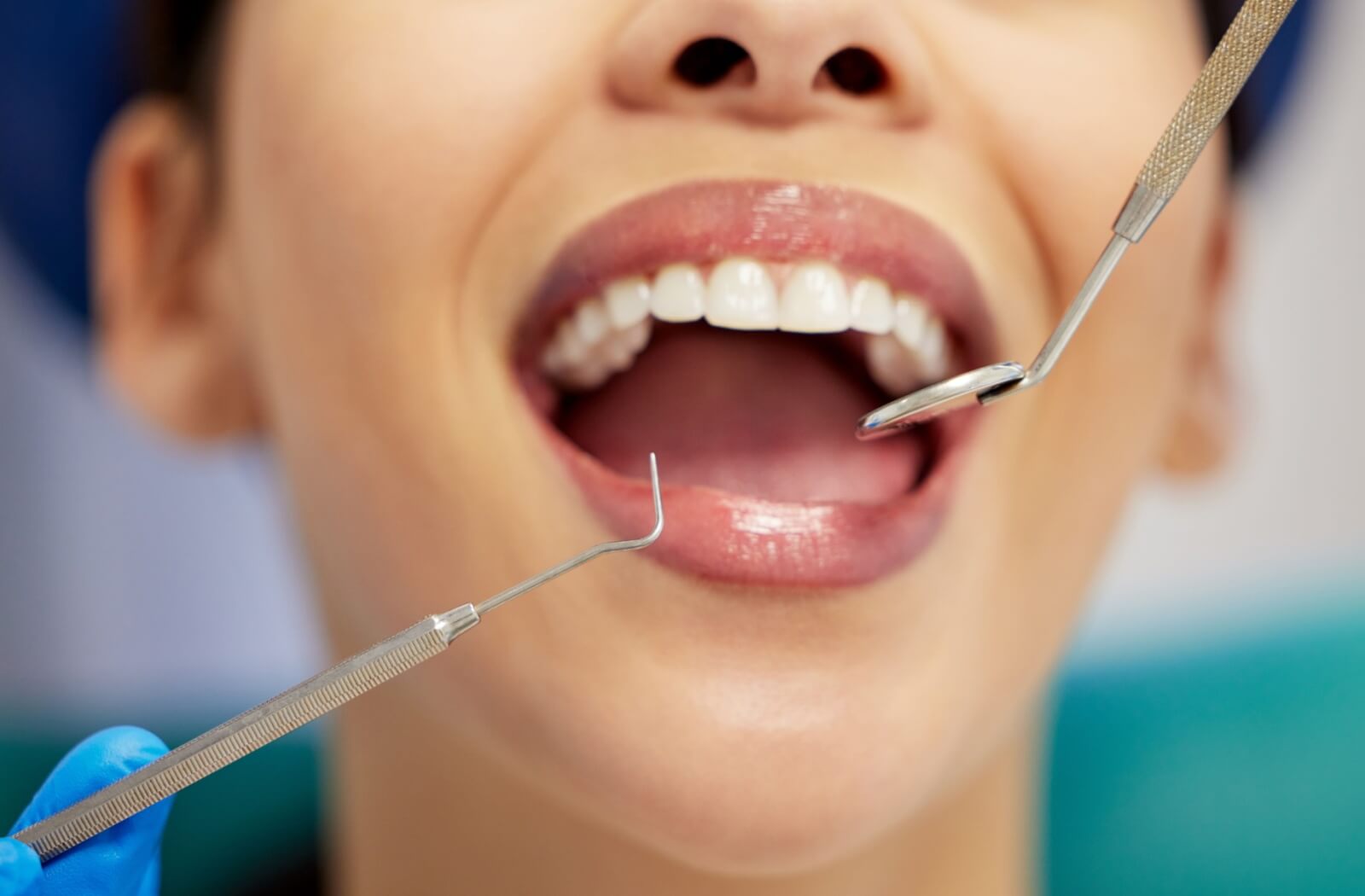 A person sitting in a dentist's chair getting a dental check-up and cleaning