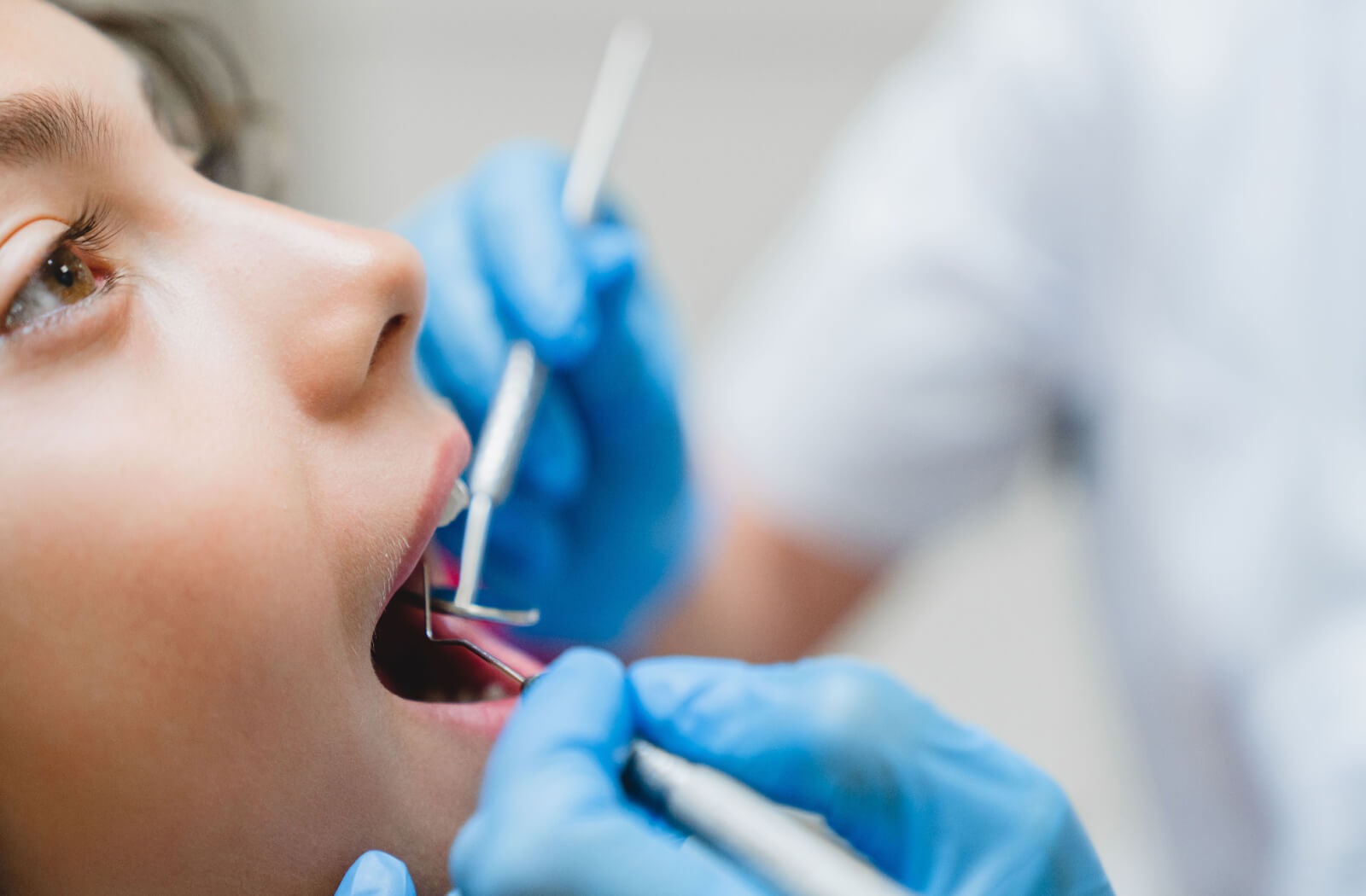 A close-up image of a patient's face as a dentist inspects their new filling for damage.