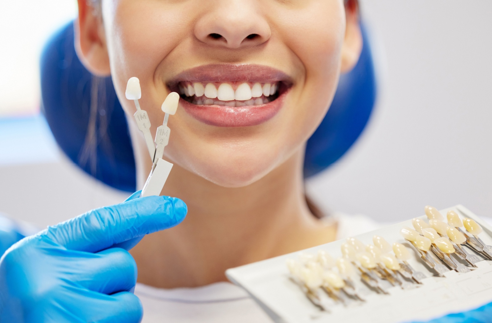 Patient holding up different teeth colour samples to assess options for whitening treatment.